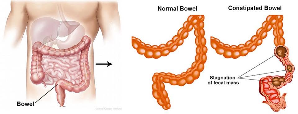 Natural Constipation Relief: A 7-Second At-Home Ritual